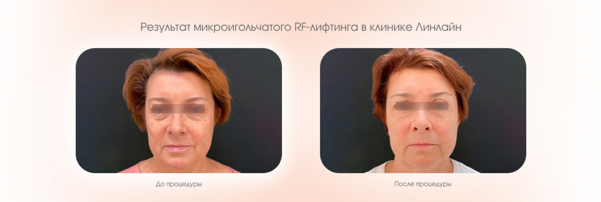 92a21cae-993d-4b17-875d-0794782923b4.png